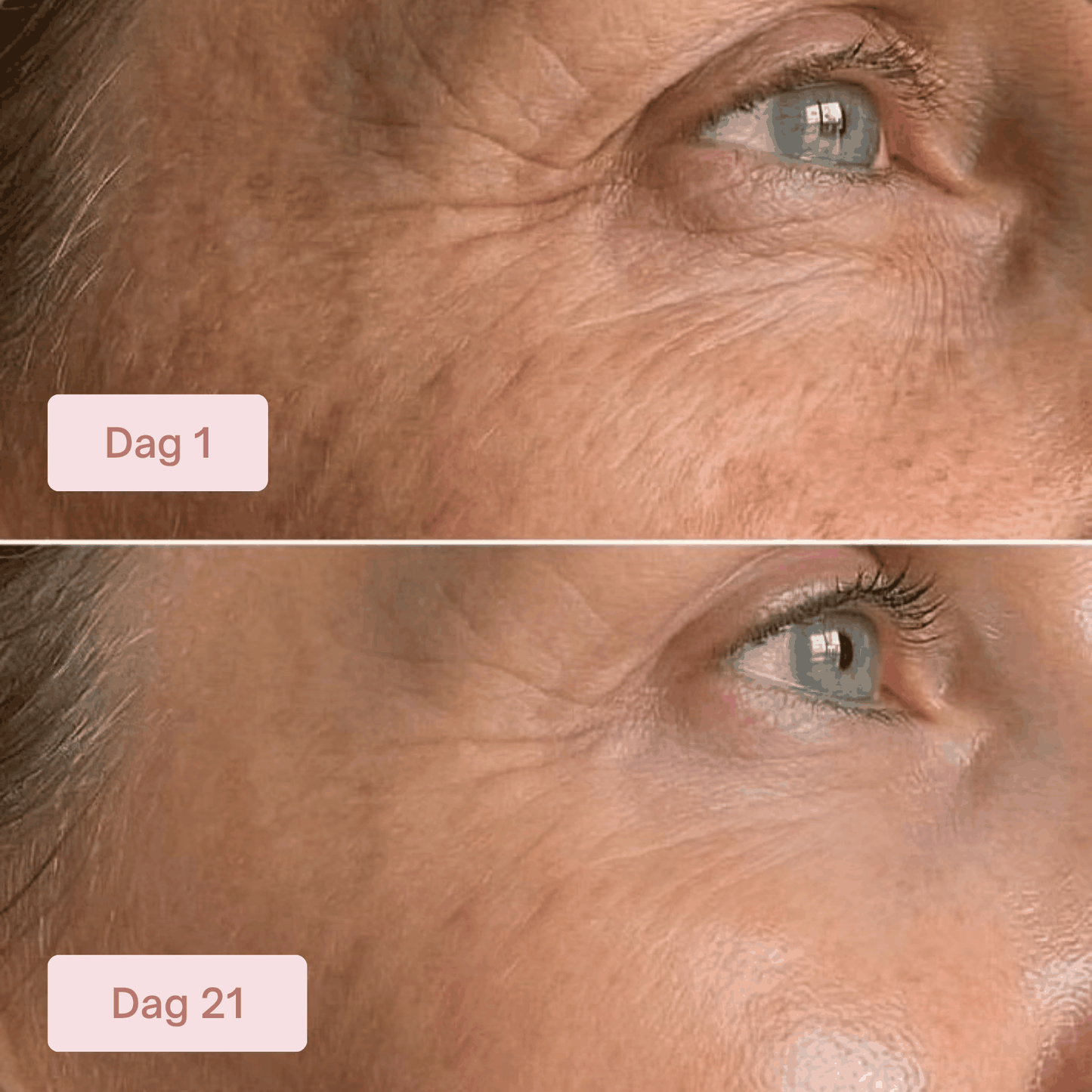 Salmon PDRN Collagen Mask (4 st)