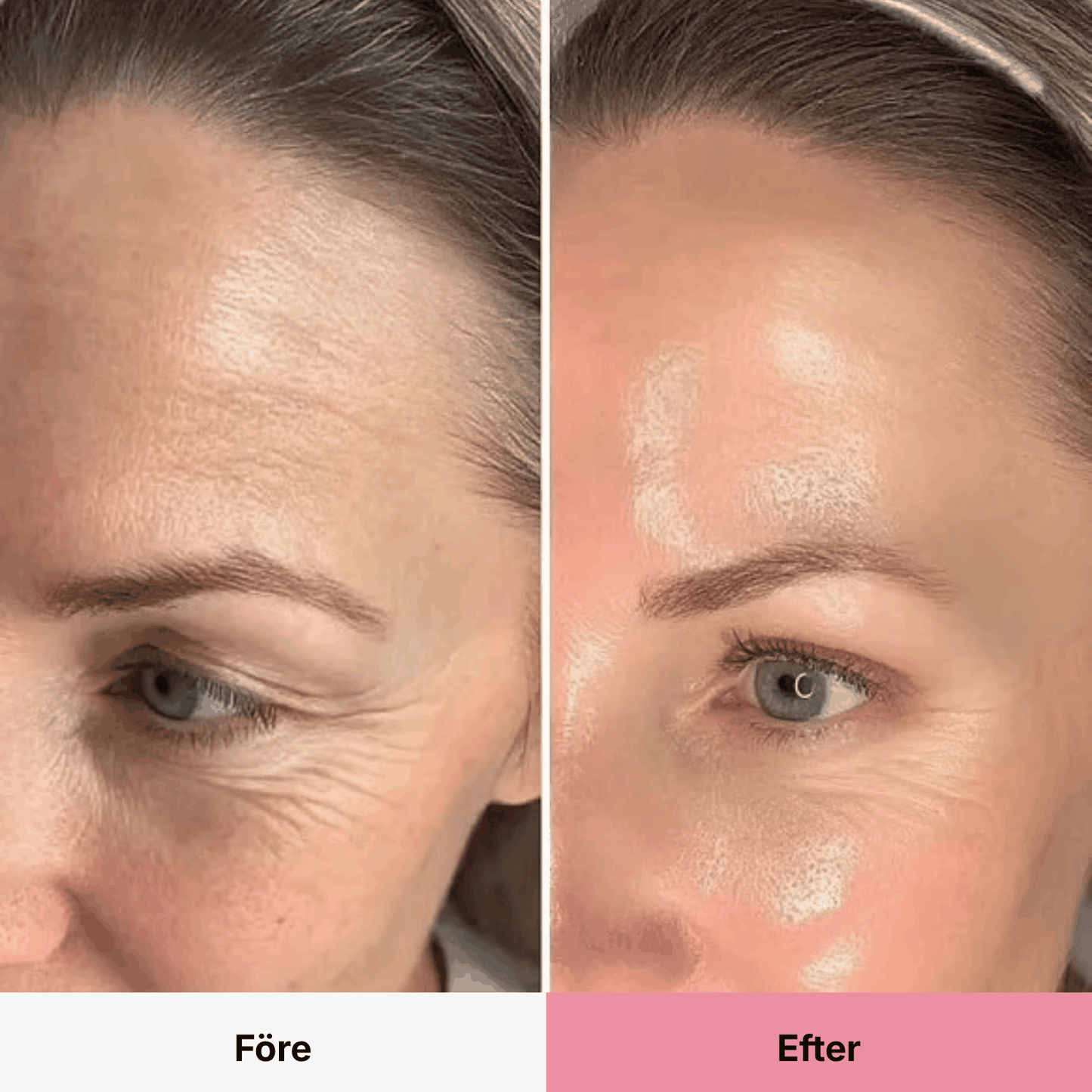 PDRN Collagen Volume Balm