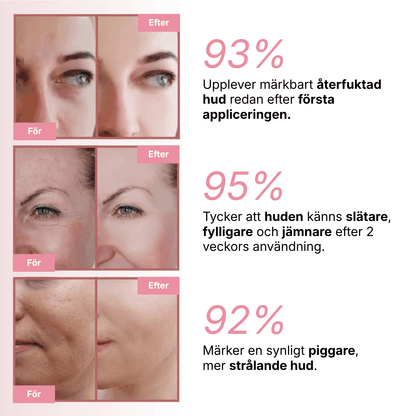 PDRN Collagen Eye Patches